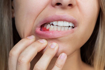 Reduces Oral Inflammation