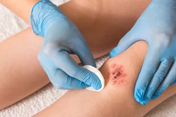Supports Wound Healing and Rectal Comfort