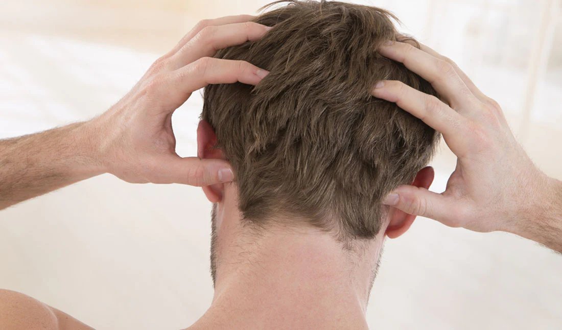 Alleviates scalp conditions
