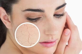 Nourishes Dry Skin