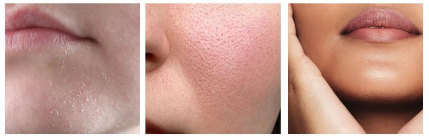 Suitable for all skin types